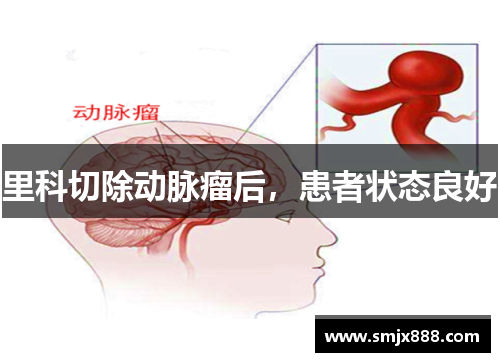 里科切除动脉瘤后，患者状态良好